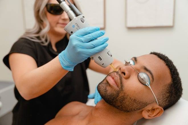 A qualified Vale Laser Aesthetics practitioner treating a client with a deeper skin tone using medical-grade laser technology in our HIW-approved South Wales clinic