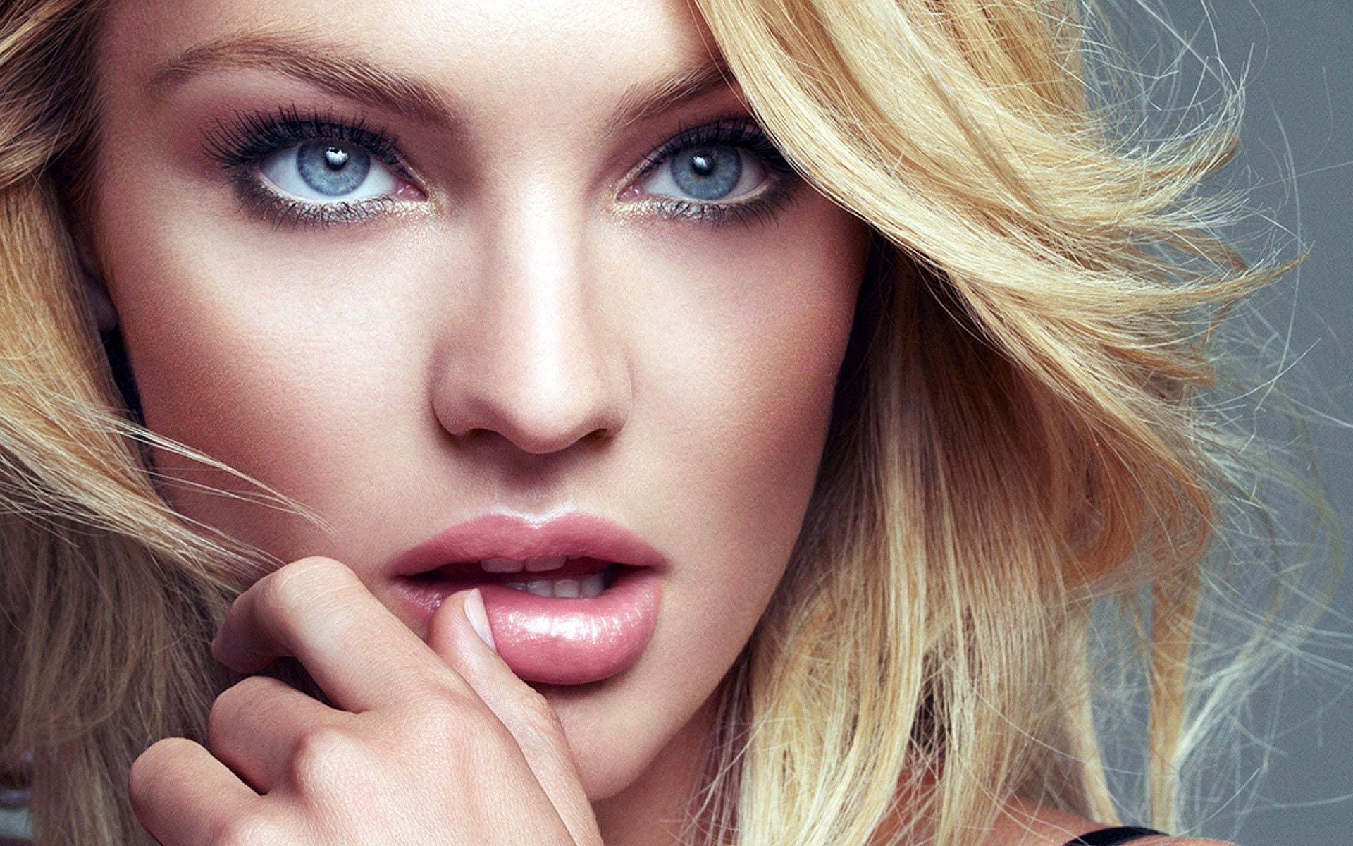 Lip augmentation treatment at Vale Laser Aesthetics