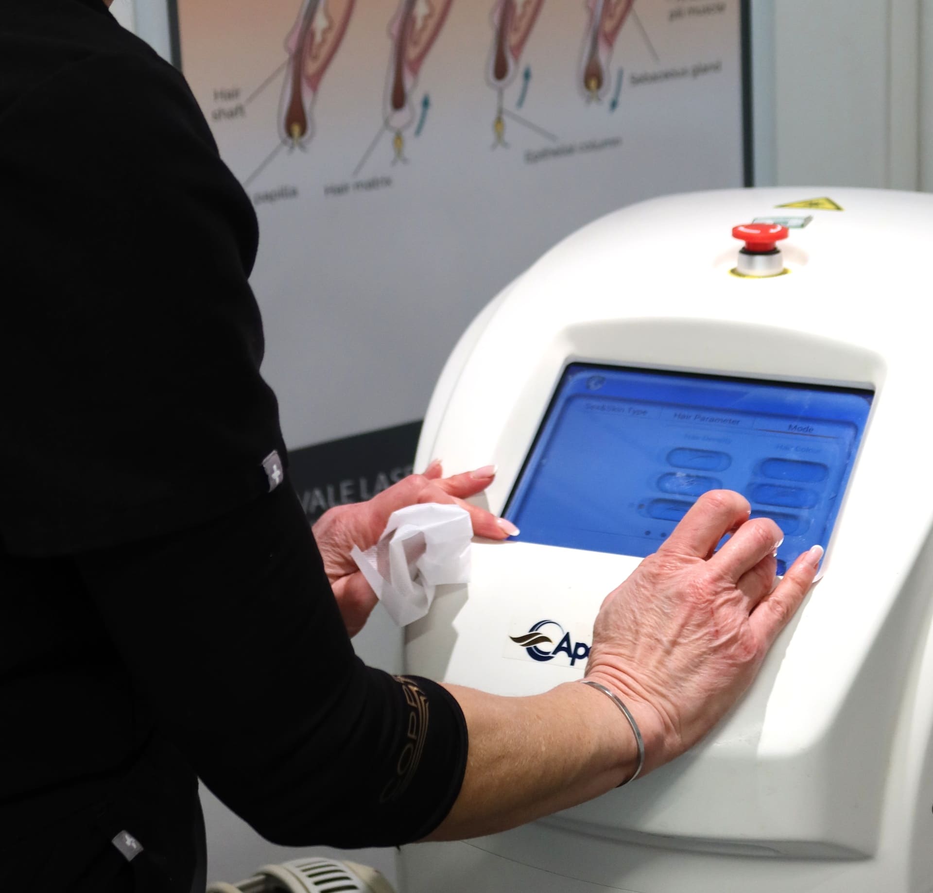 Practitioner operating laser hair removal device at Vale Laser Aesthetics Whitchurch